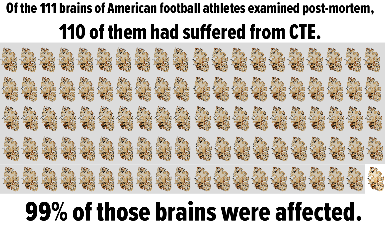 99%brains.png