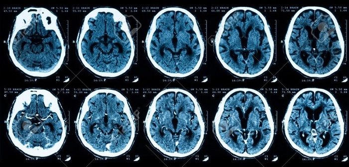 brain2.jpeg