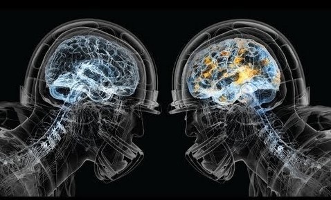 Brain1.jpeg