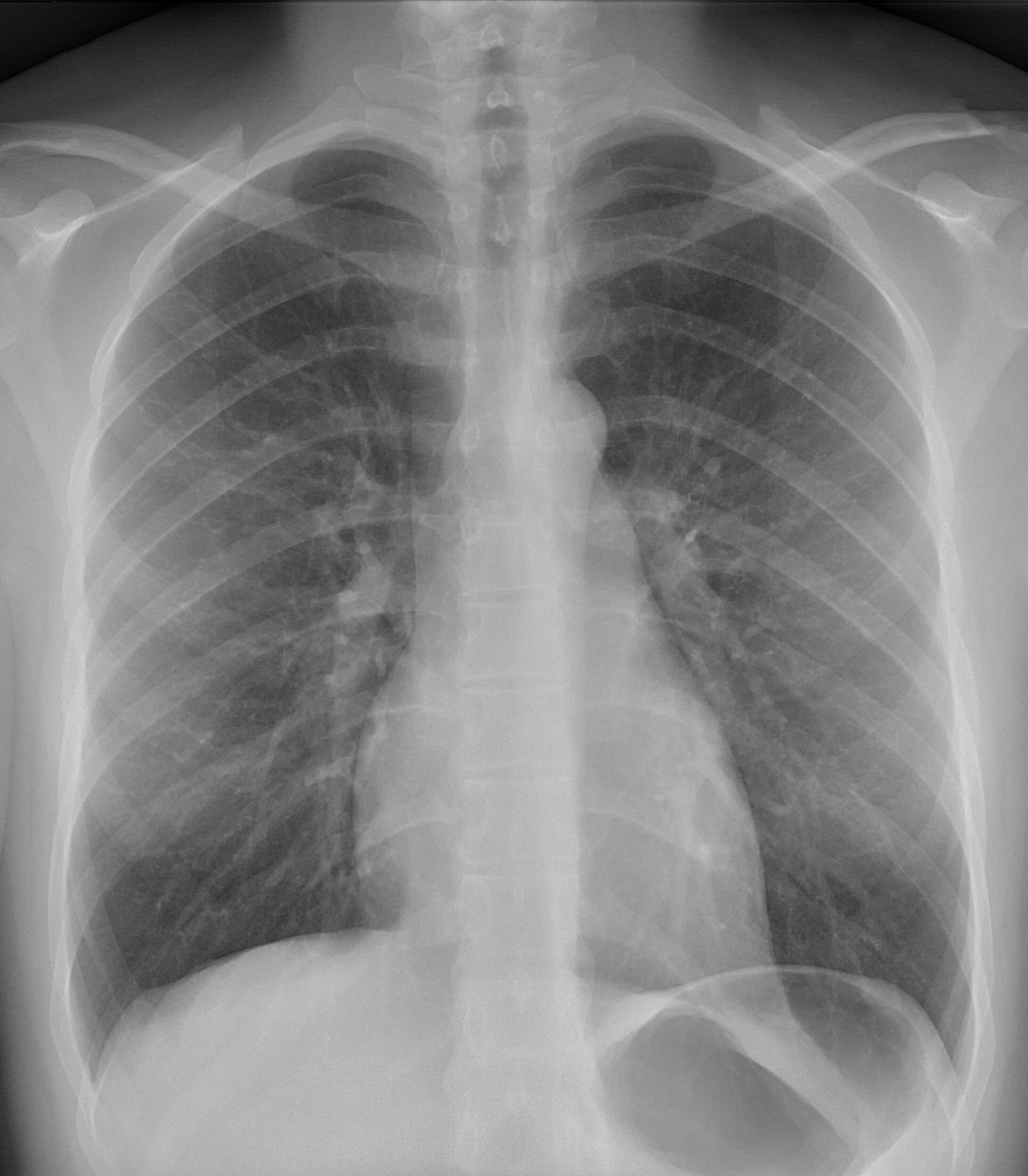 healthy lung.jpg