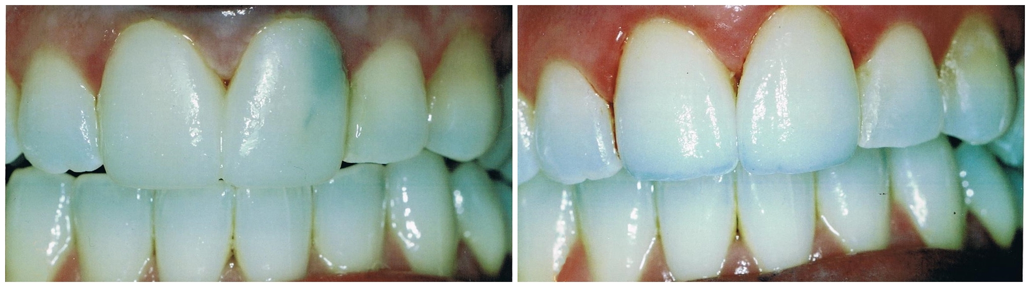 010 Before and After Scanned-tile.jpg