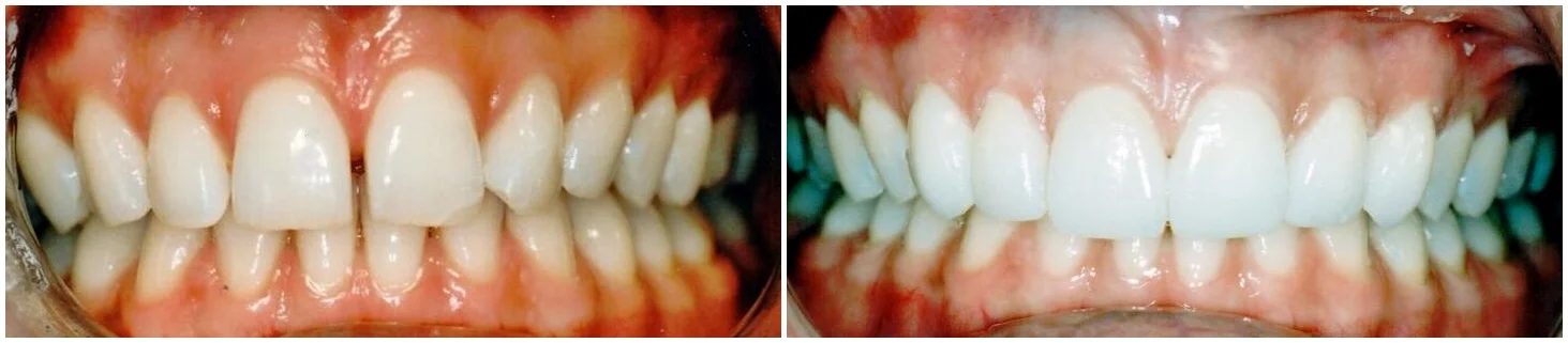 016 Before and After Scanned -tile.jpg
