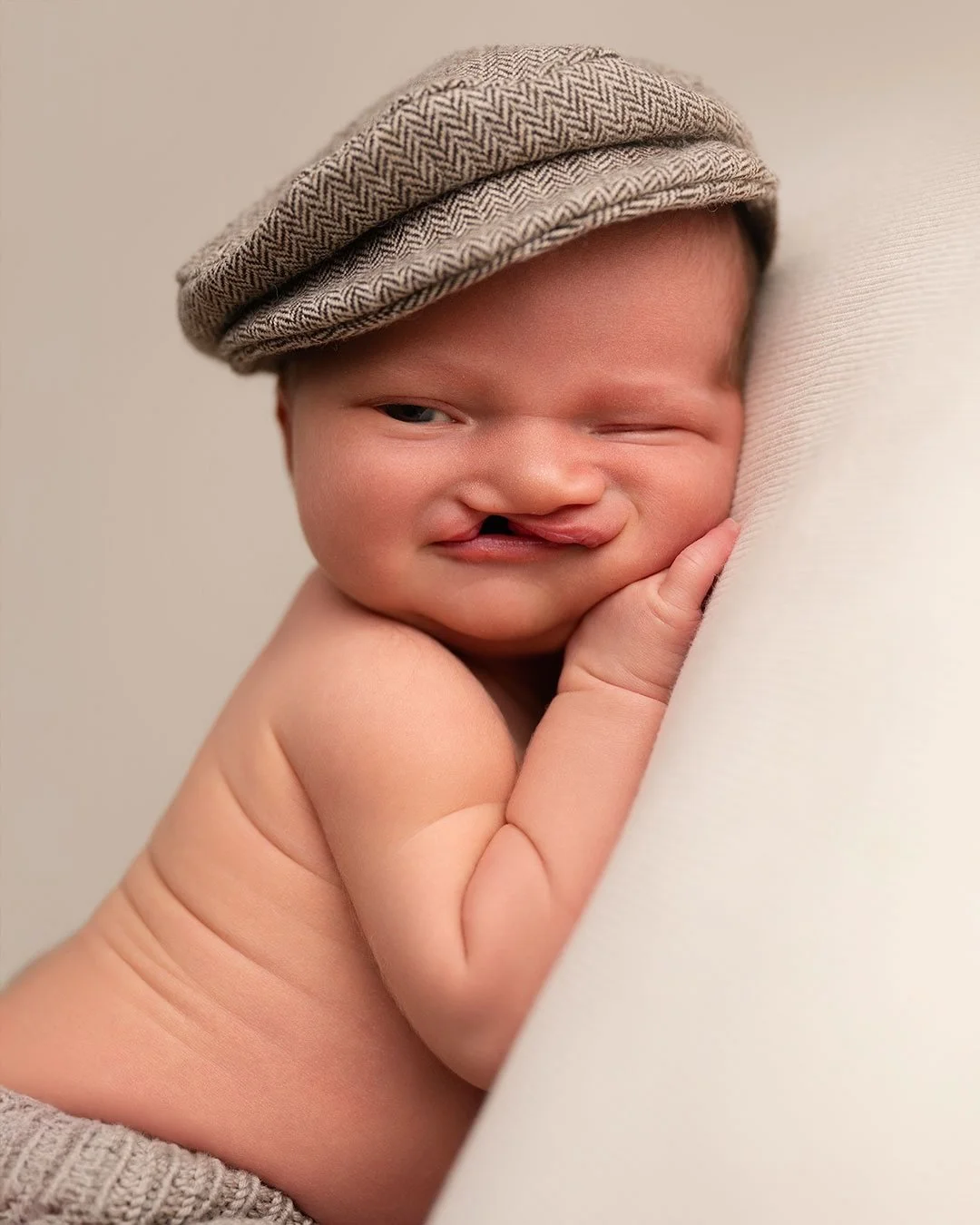 Bare noen f&aring; dager gammel m&oslash;tte jeg denne lille gutten for f&oslash;rste gang, nyf&oslash;dt, s&aring;rbar og perfekt akkurat som han var.

Snart kommer han tilbake til meg igjen,  seks m&aring;neder gammel. Operert. Sterk. Med sporene a