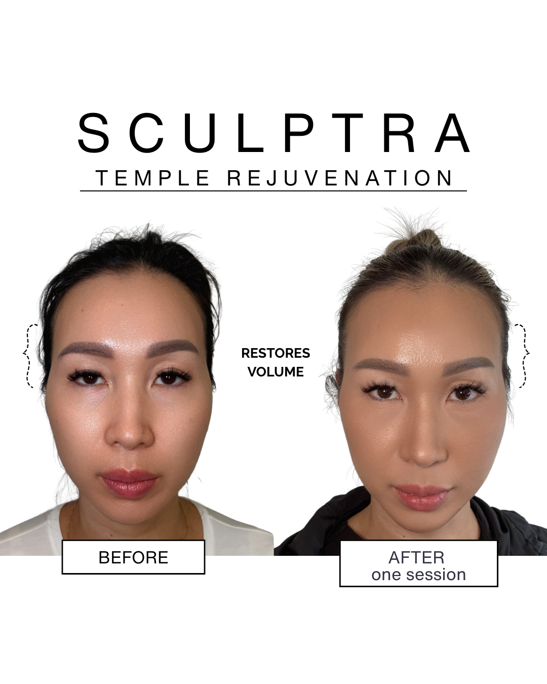 temple rejuvenation.png