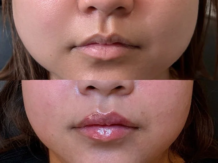 mini lip plump.JPG