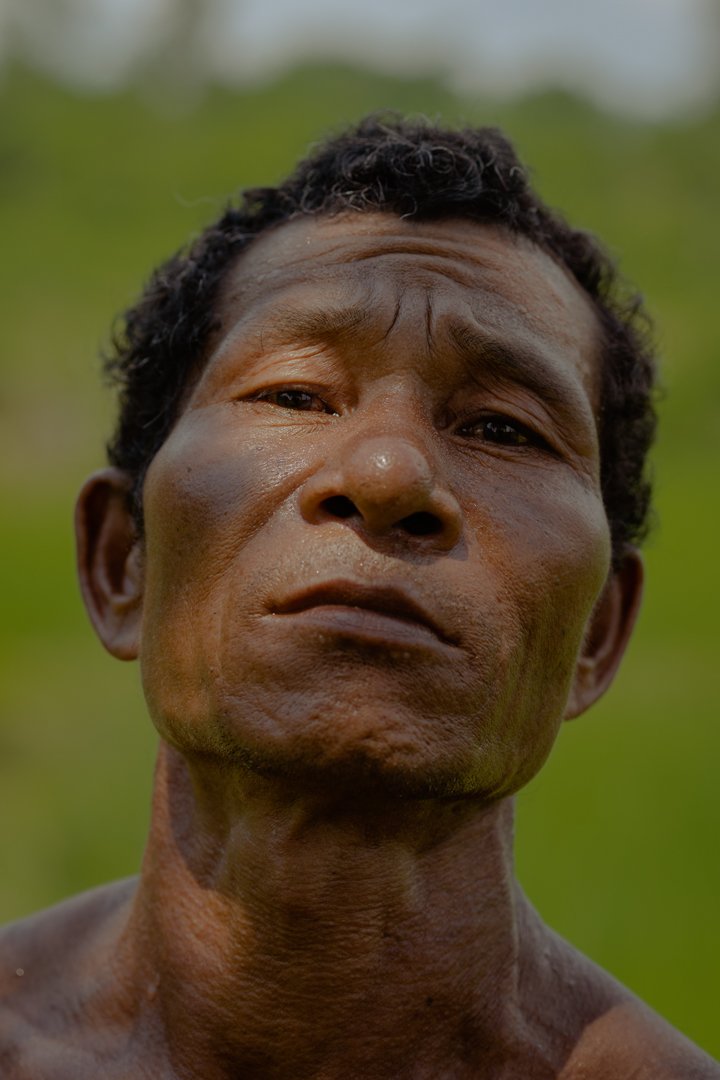  Joising Dophu, farmer, suffered a serious injury caused by an elephant. While defending his crops, the elephants chased him, he fell and one stamped on his ribs. The other villagers rescued him and brought him to the hospital. “I almost died”, said 