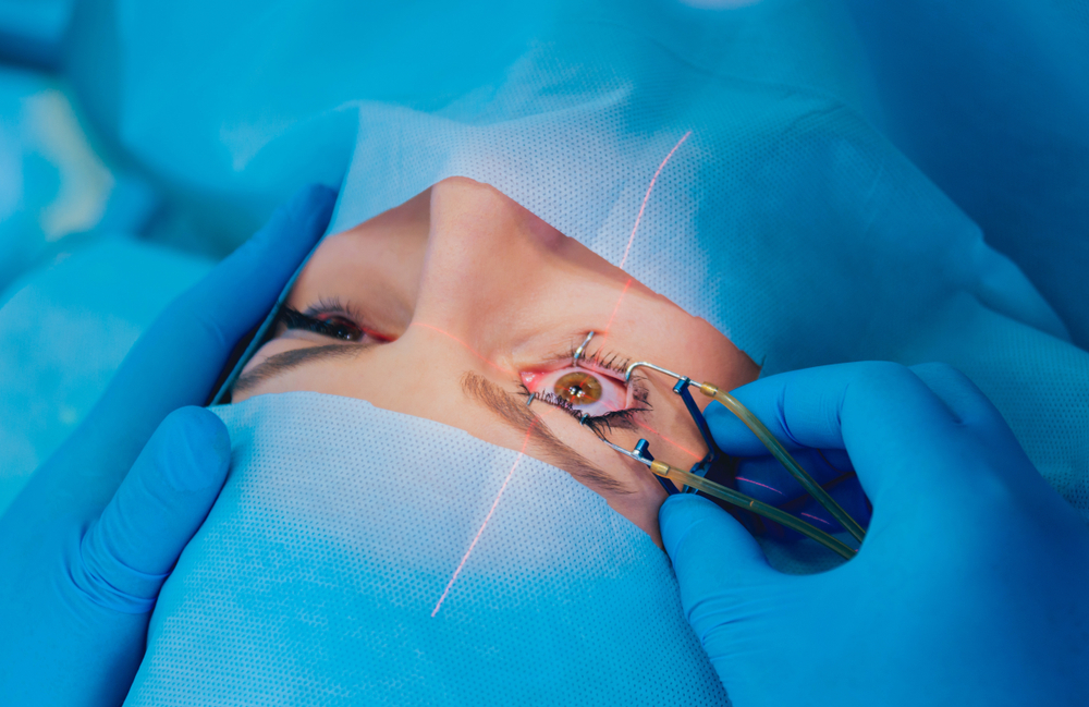 cataract eye surgery.jpg