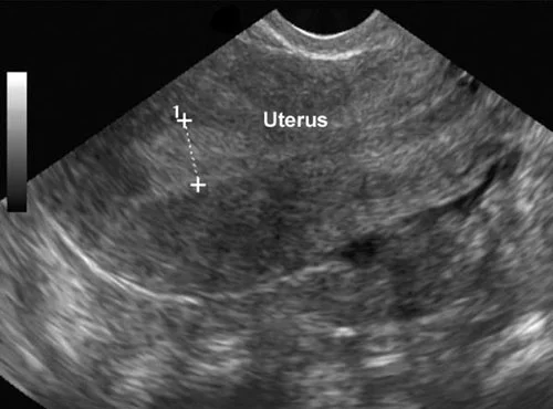 Gynae Image.jpg