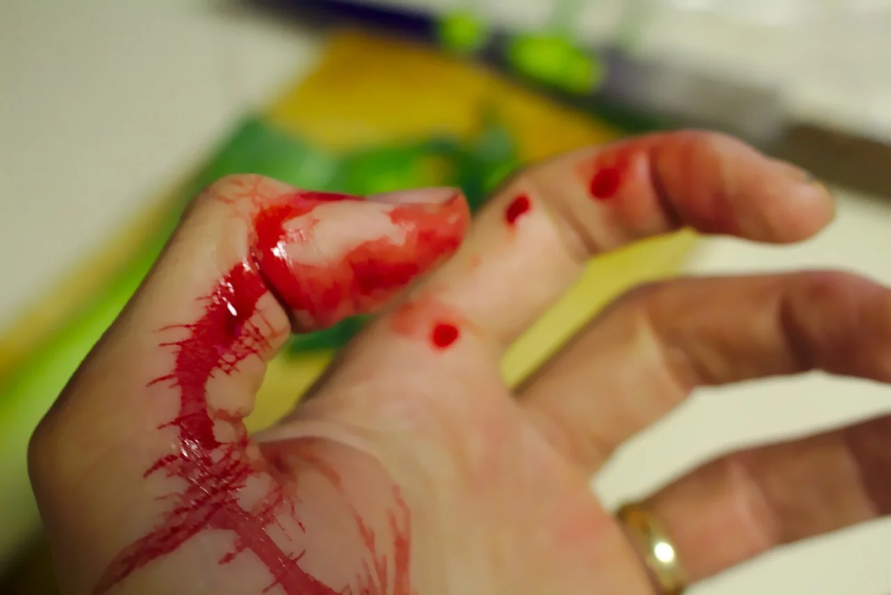 accident-743035_1280.jpg