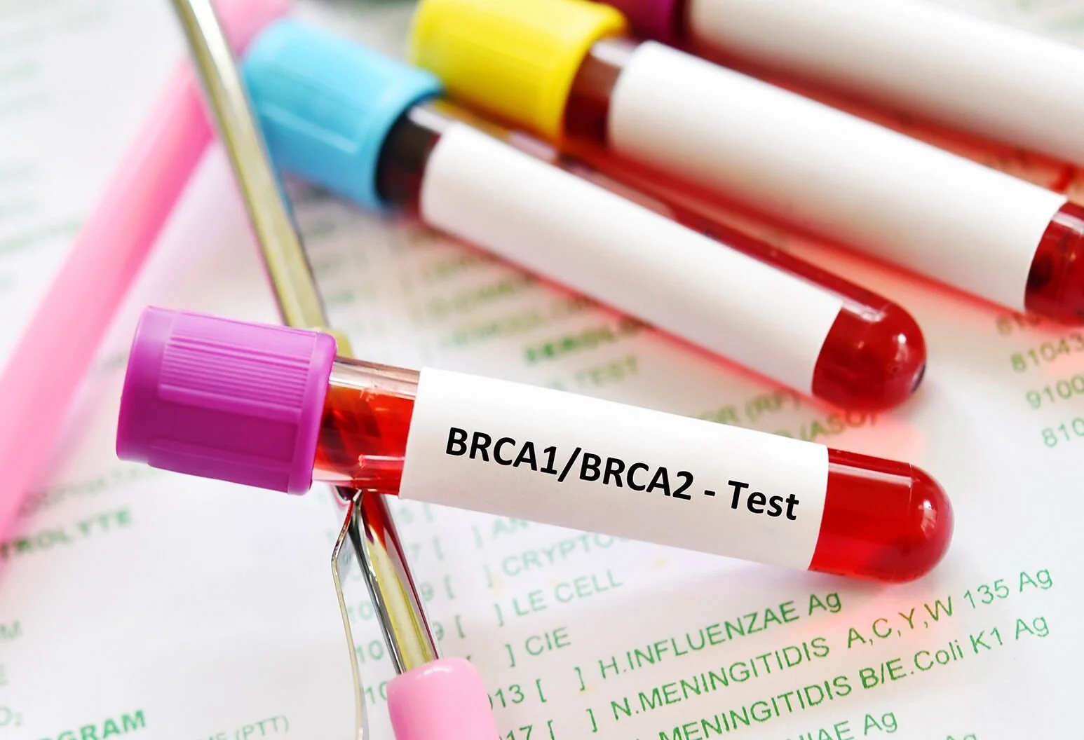 What You Need To Know About BRCA Genetic Testing