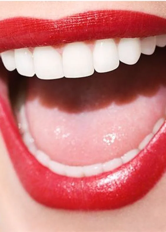 LIFE ★ SPARKLE TEETH WHITENING