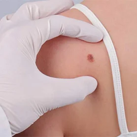 Skin-2.jpg