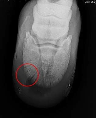 May 27, 2010 - After only four shoeings, the fracture is almost completely healed.