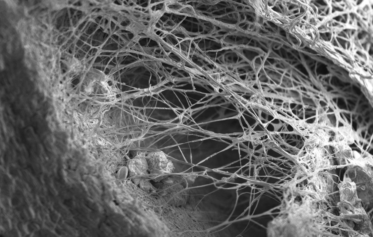 Hyphae-and-Mycelia.png