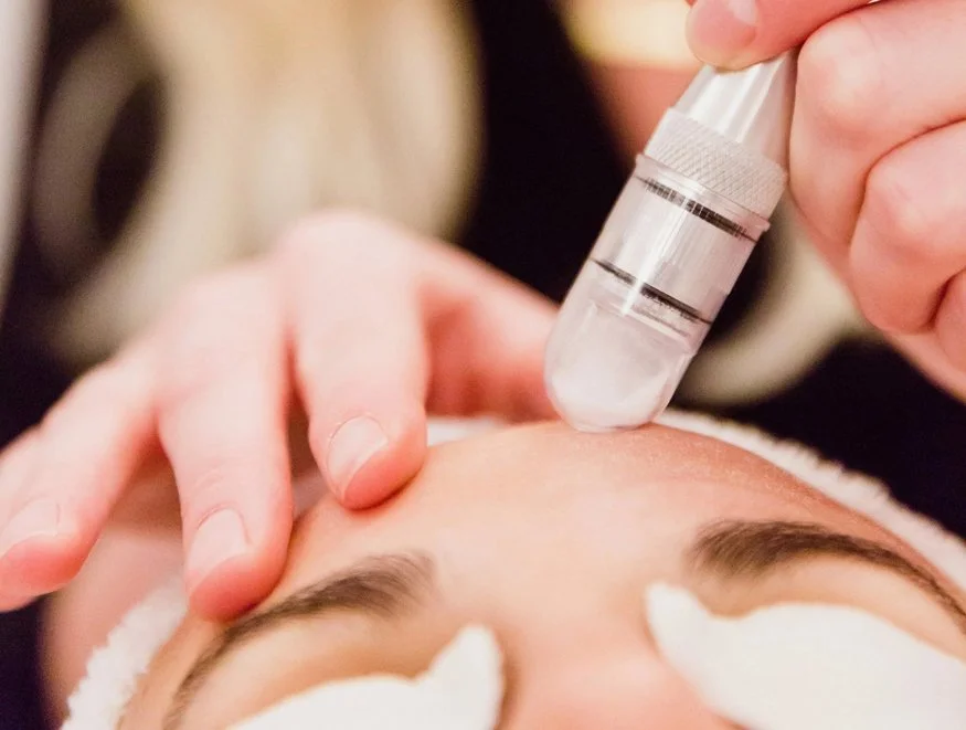 Microdermabrasion