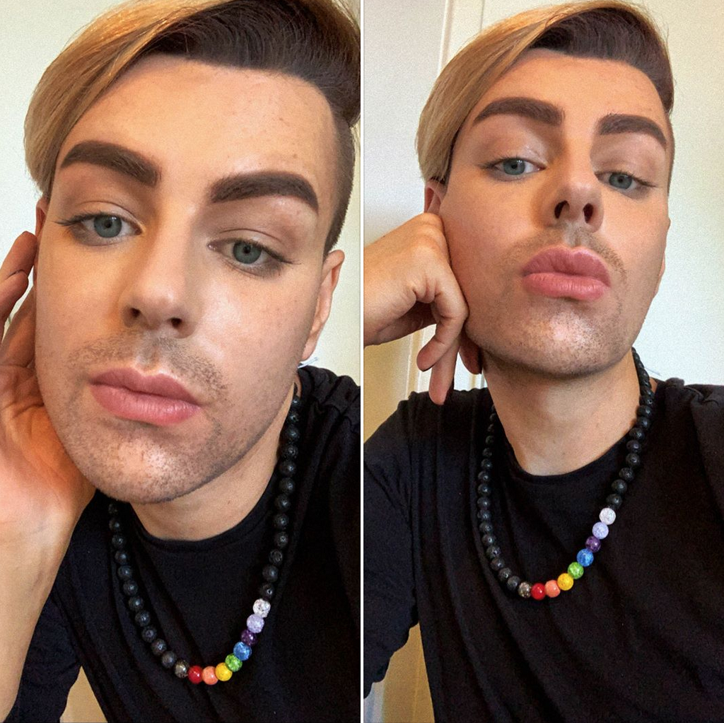 My Skin Fast Part II