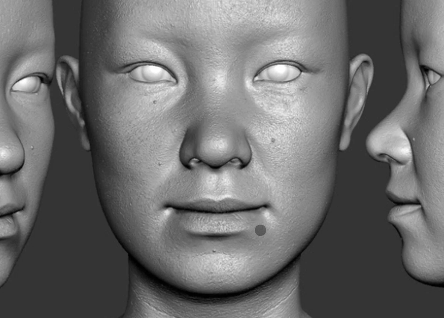TretDirect Accutane Focus