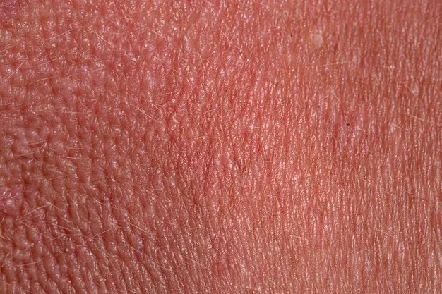 Redness and Rosacea 