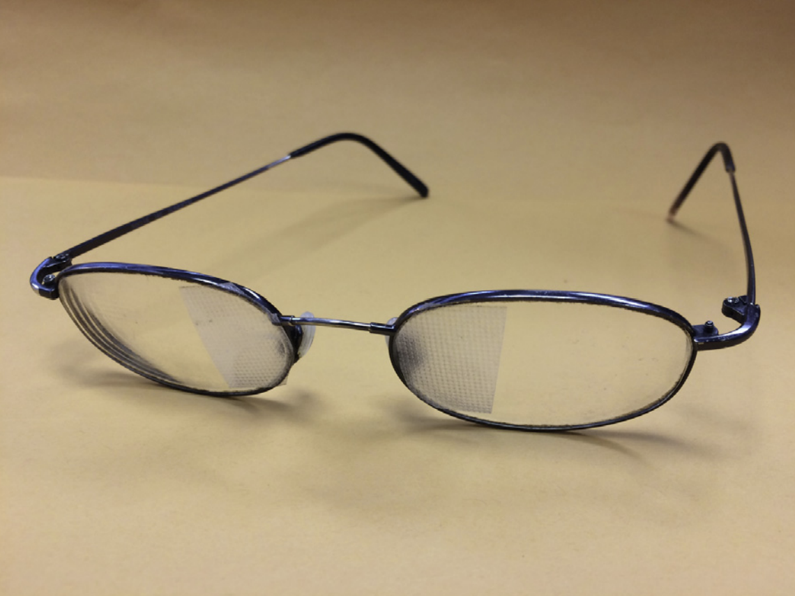 Vestibular Therapy — Concussion Alliance