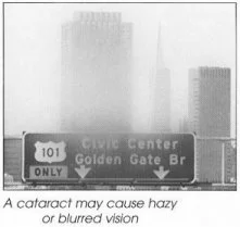 cataract2.jpg