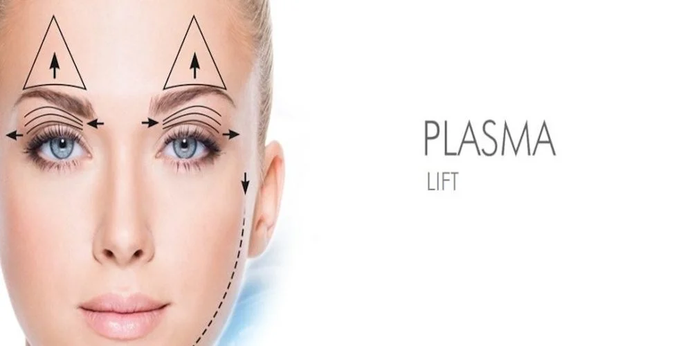 fibroblast plasma lift