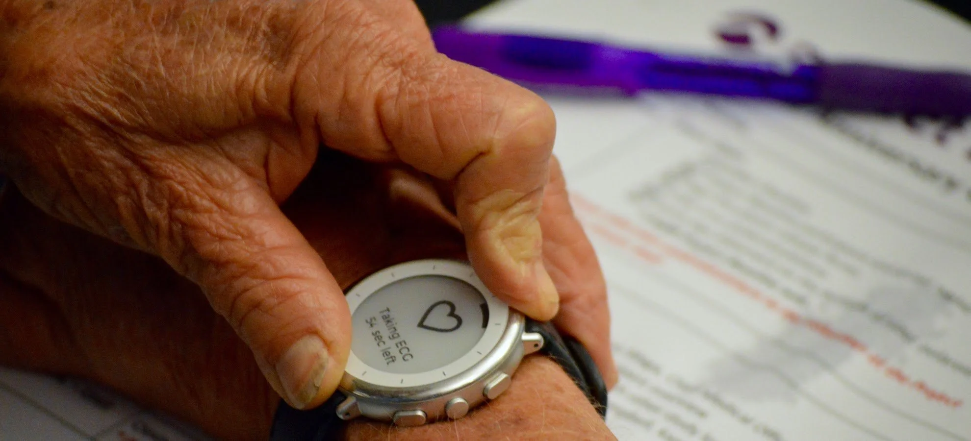 Study Watch ECG.jpeg