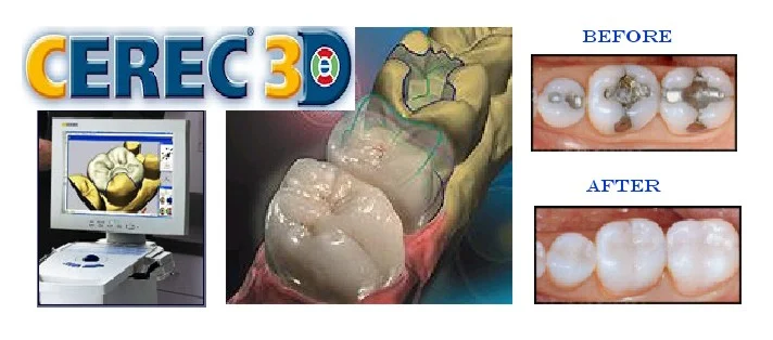 Cerec Banner.jpg