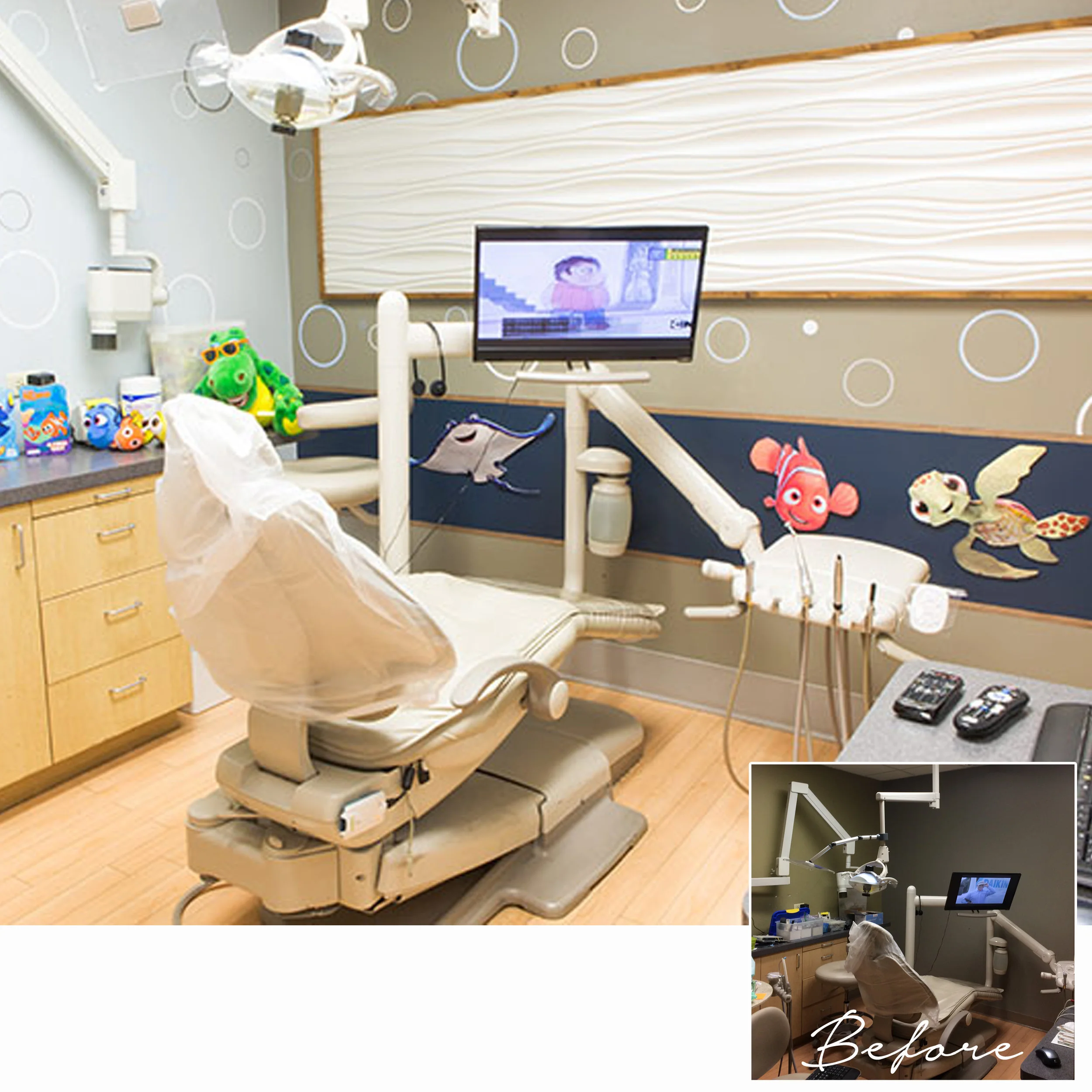 Before and After_Arbor Dental3.jpg