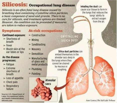 Silicosis.jpg