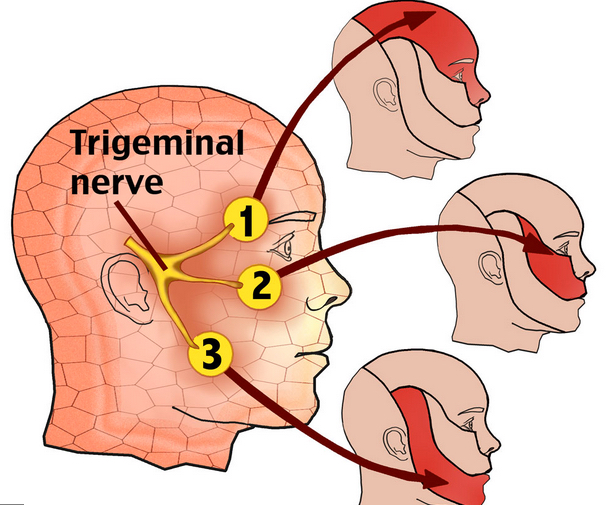 Trigeminal 1.jpg