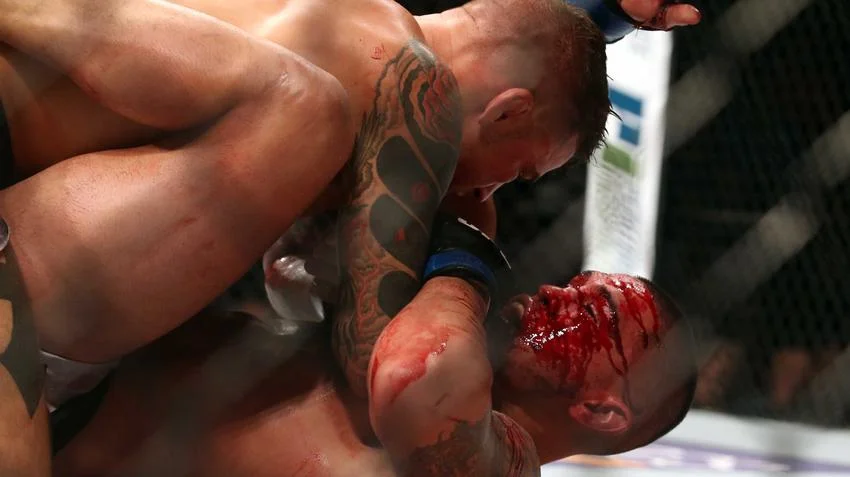 Pettis vs Poirier: A Strange, Bloody, Exhilarating Fight [Vice Sports]