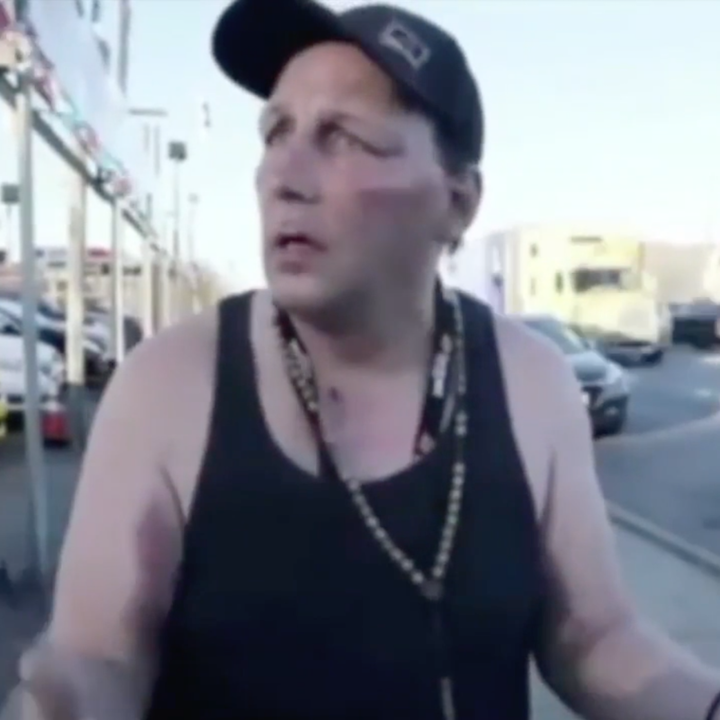 (Chicago Tribune) Man tells about getting beat up by “African American” Trump-haters in 2016
