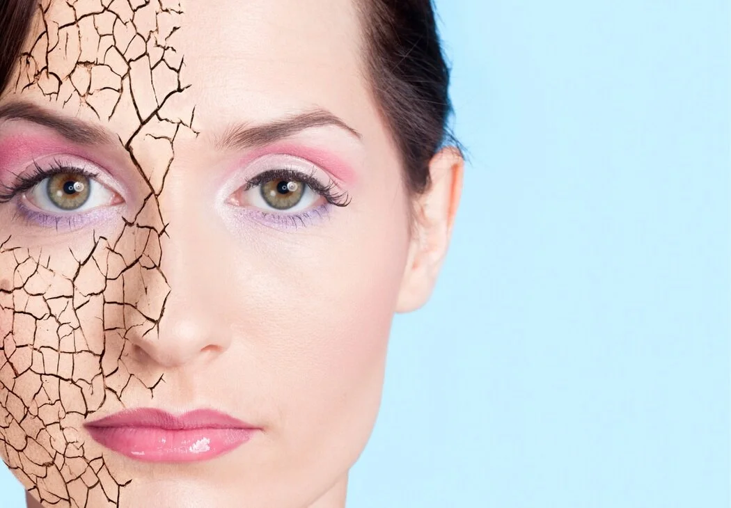 Dry Skin