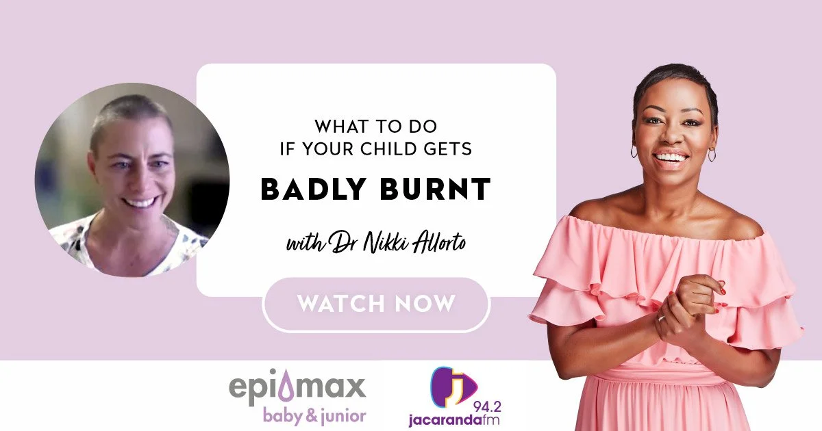 What To Do If Your Child Gets Badly Burnt