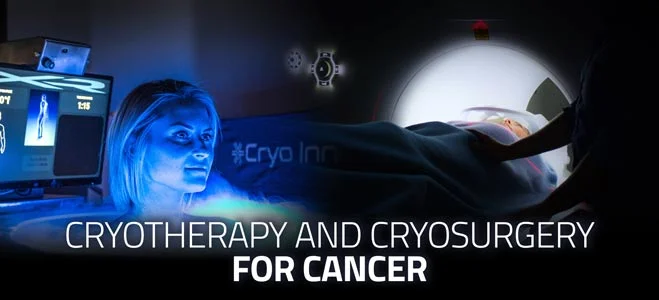 Cryotherapy and Cryosurgery for Cancer