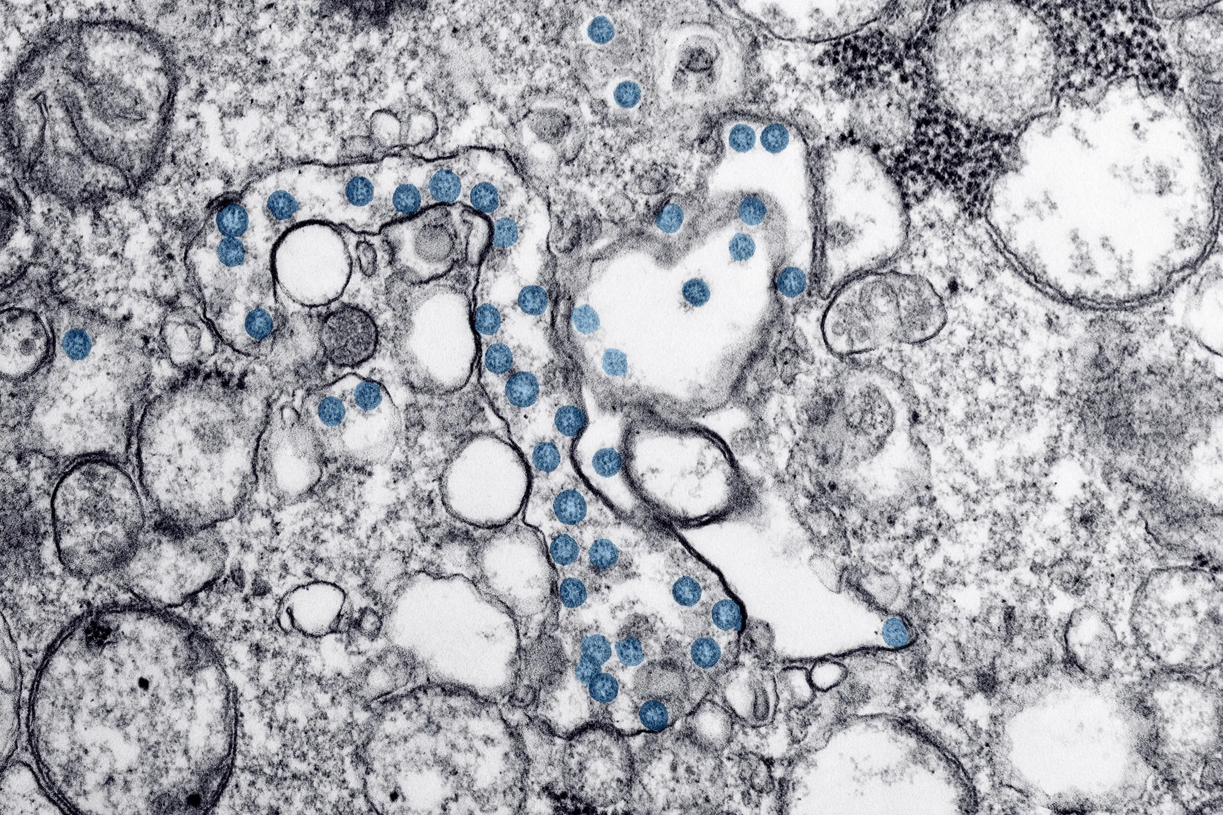 Three Bat One Health researchers quoted in Washington Post article about spillover