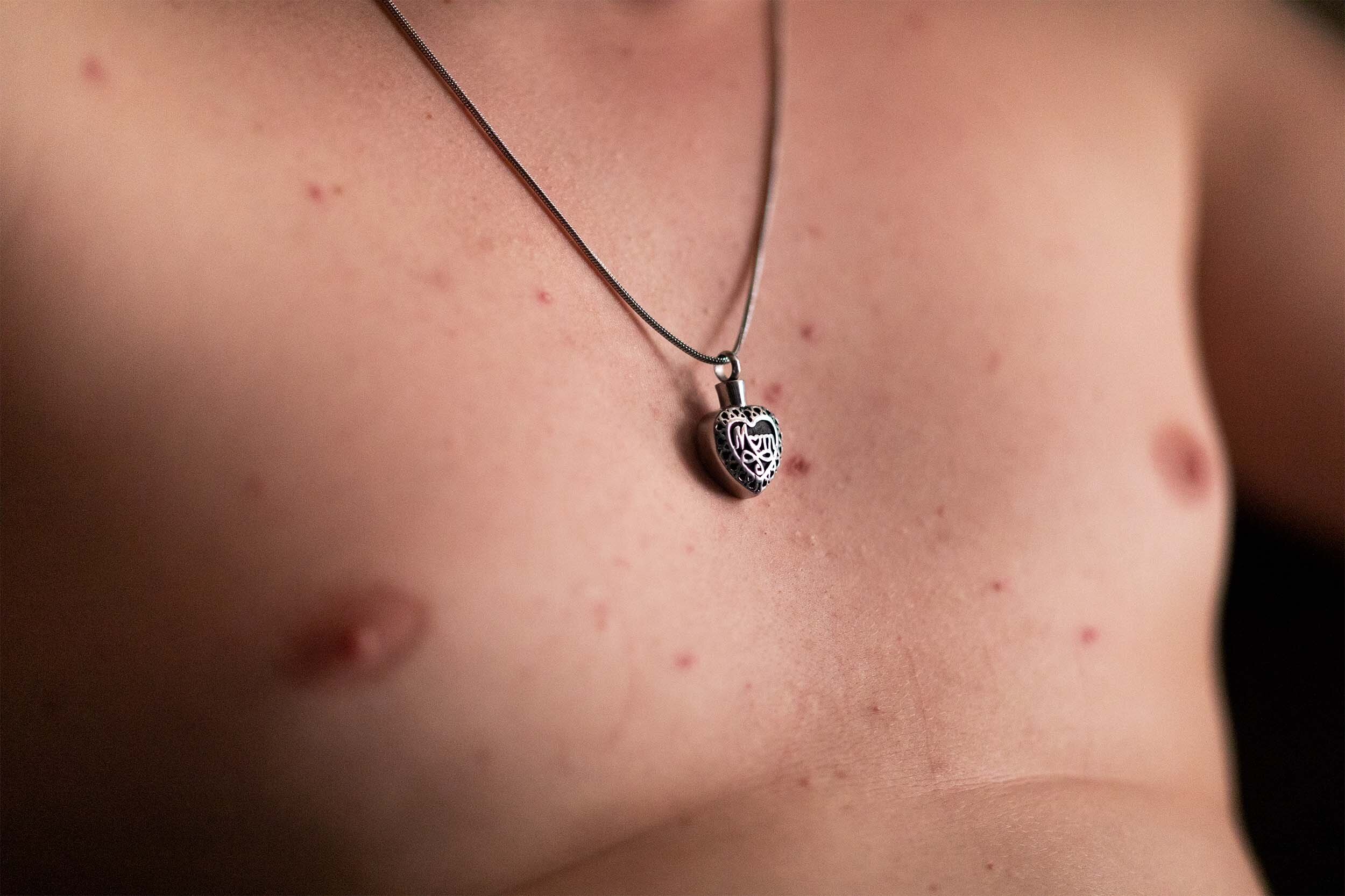  Reuben wears a heart pendant around his neck containing his mother, Genevieve Brown’s, ashes after she died from cancer in February 2020, on May 25, 2021. “When my mom was dying, she was on her deathbed crying begging me to get off the needle, and I