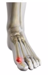 joint.png