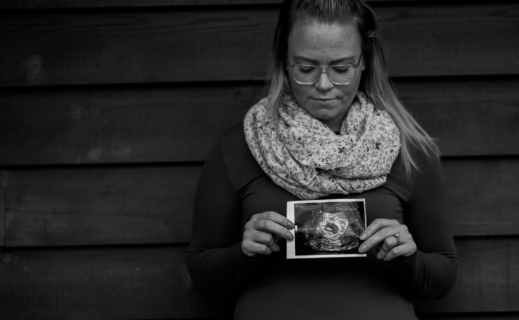 This is one of the hardest things I’ve ever gone thru in my life. I was 14 weeks when I started to spot a little. I wasn’t too worried until it got heavier. I went in to urgent care and they ordered an emergency ultrasound for the next day. I tried to convince myself everything was going to be okay. When I knew it wasn’t. I didn’t sleep. I went to the ultrasound the next morning with my two year old. The tech had a difficult time finding a heart beat. My worst fears had come true. But she soon loosen the giant knot that formed in my throat. She said the baby was healthy and even asked if I’d like a photo. I eased the mind of my frantic fiancé, I left him the ultra sound photo on his pillow as I left on a 3 day road trip to Alberta. She was wrong. She was really, really wrong. That night in a hotel in a small town I started to miscarry. Right there, in a hotel room without my fiancé. Without the professional care I should have had. I had my two beautiful little girls with me and my mom. After that I tired to continue the trip normally. Pretend nothing happened. Enjoyed myself best I could. But I’ve never felt a loss like that, the heart ache I couldn’t describe dragged me down daily. A few weeks went by and something wasn’t right. The bleeding hadn’t stopped, the headaches still throbbed daily. I went back to urgent care. I had actually never fully miscarried. In a cold room on a Friday night, with my feet in stirrups and a warm blanket covering any bit of body it could. With forceps in his hand he completed the miscarriage. I laid there. I wanted to weep, I wanted to scream, I was SO mad. Mostly at my myself, my body and the disappointment I had in myself. I carried two beautiful girls to full term previously. Why couldn’t I a third time. This time was different. The man that stepped up to help raise two girls wanted to share the happiness of pregnancy with us. And I couldn’t do it. The disappointment is what hurts the most, I think. -Jessica