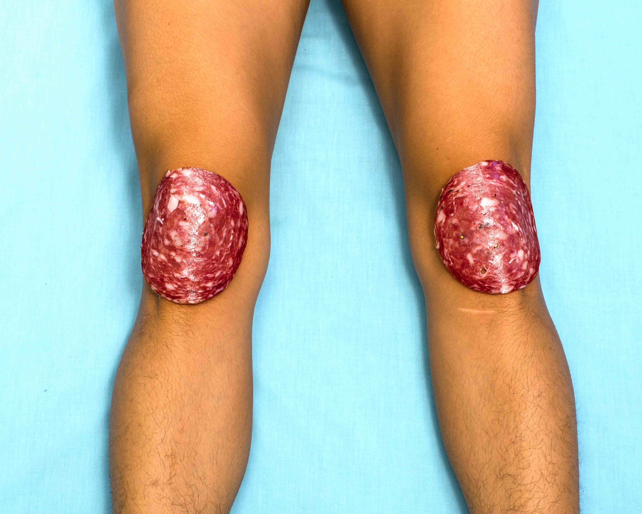A Kneed for Salami