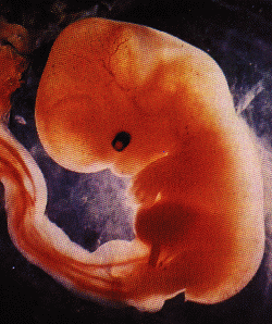 06week-large.gif