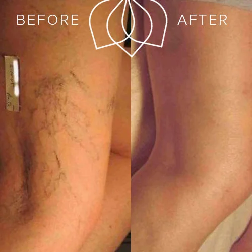 veins1.jpg