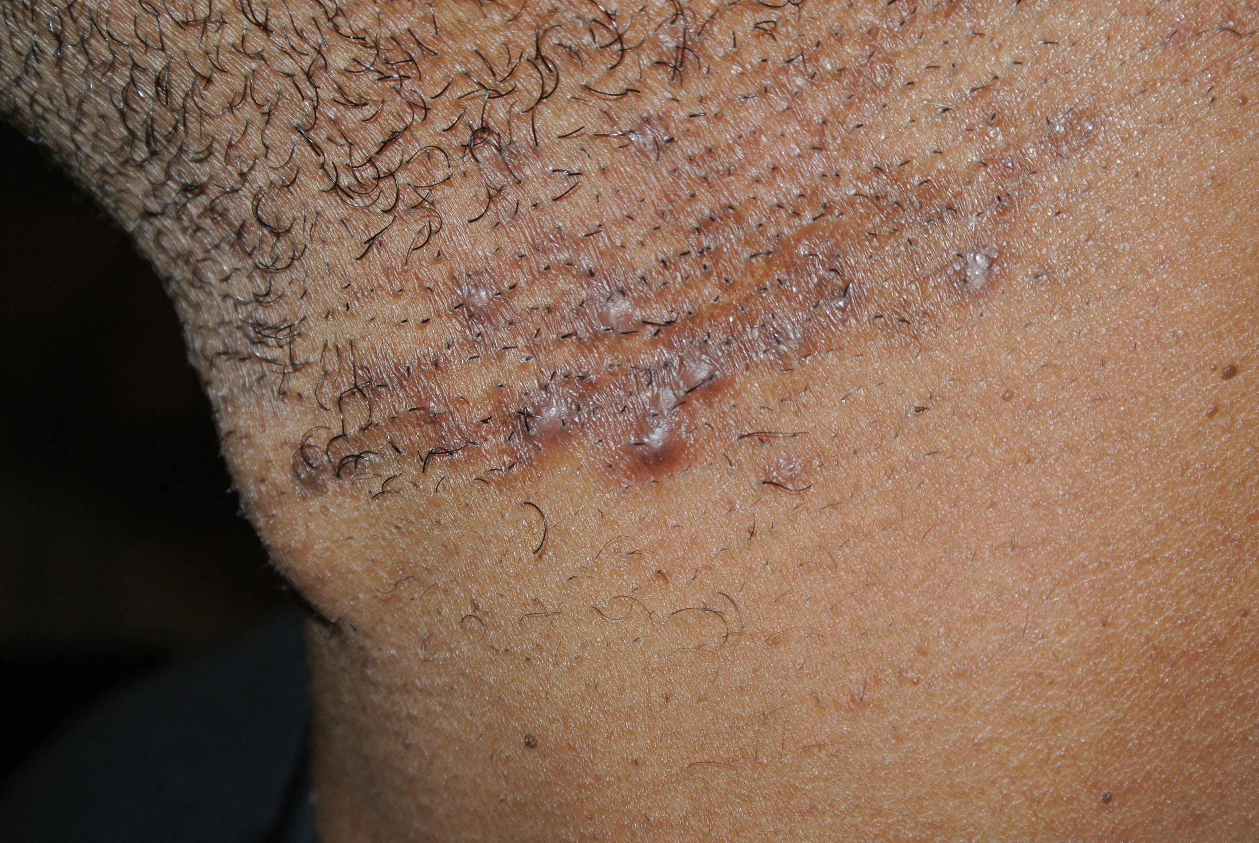 Skin Conditions Pretty Faces Atlanta