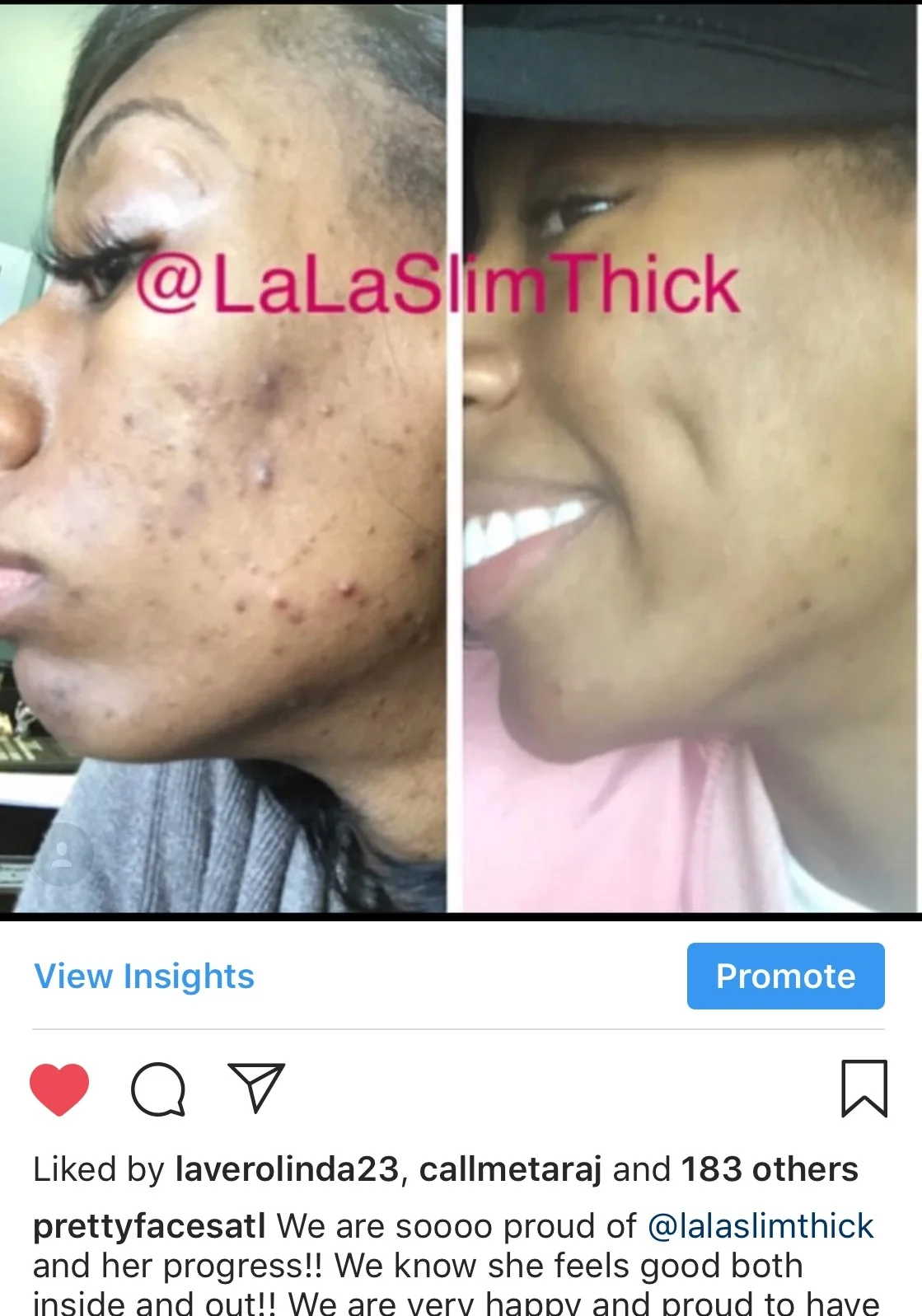 Skin Conditions Pretty Faces Atlanta