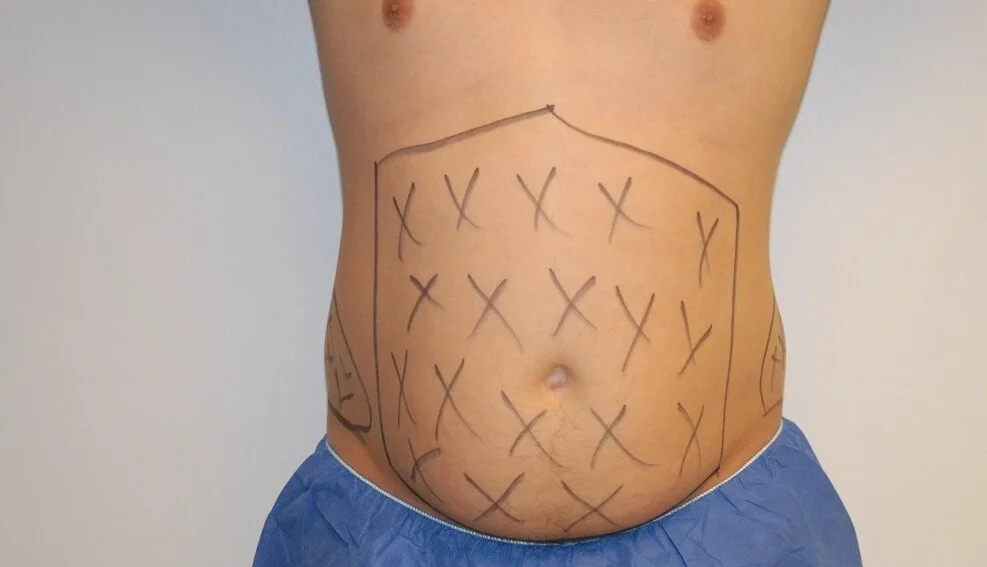 ri anterior view before surgery.jpg