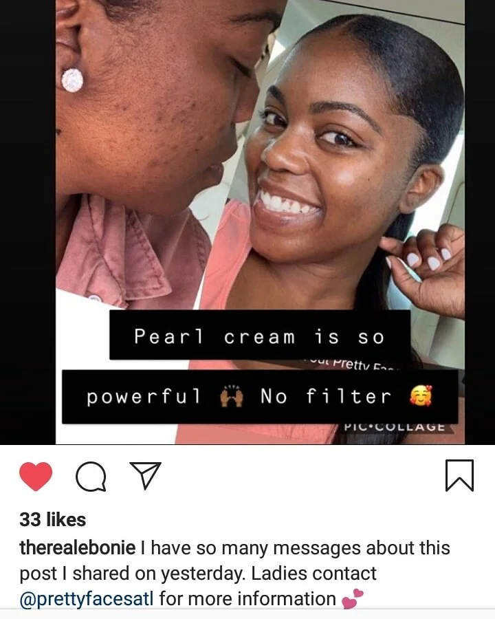 PFA before and after pearl cream.jpg
