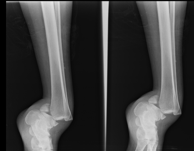 ankle 2 .jpg