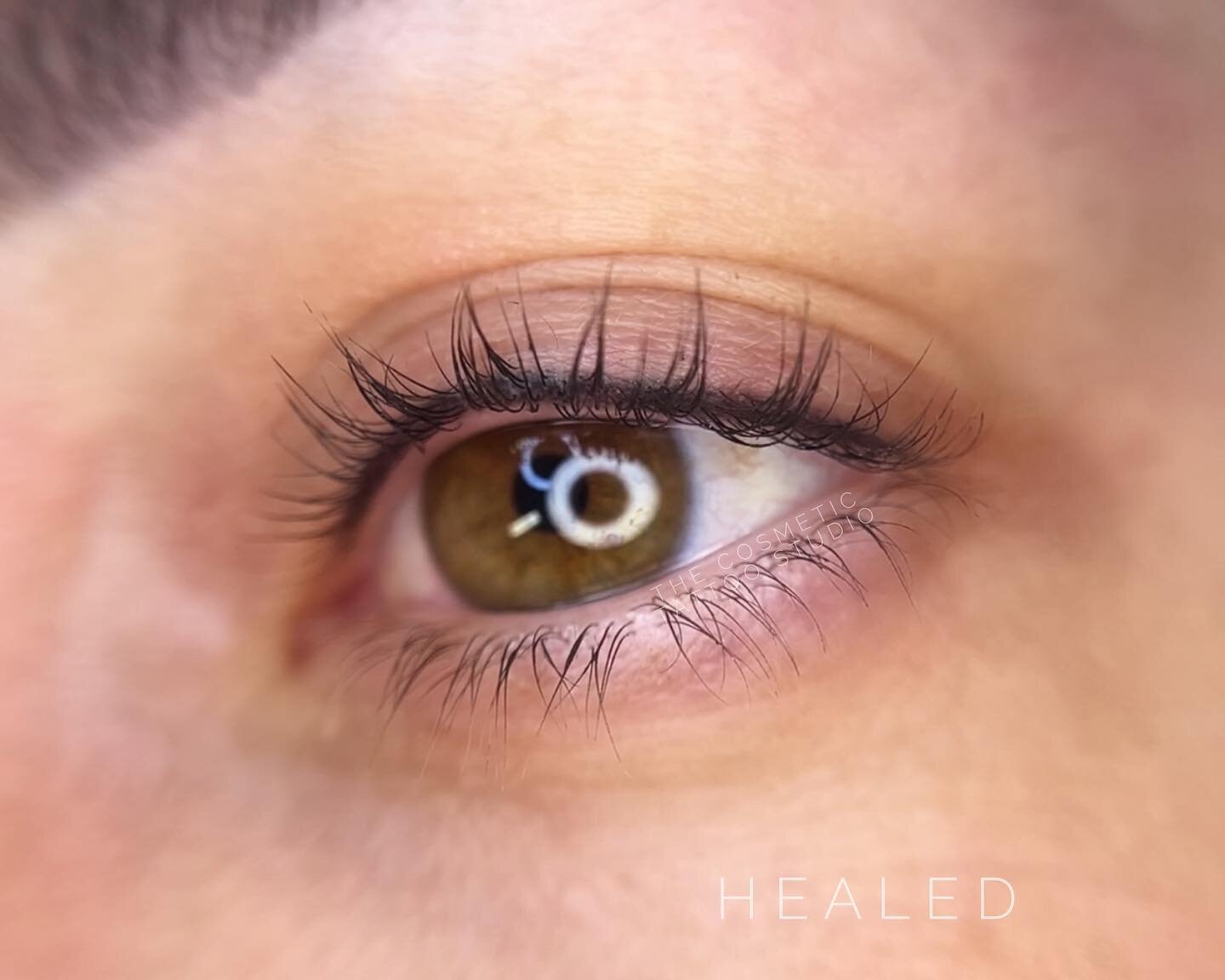 HEALED lash enhancement eyeliner tattoo 🖤

The perfect way to define the eyes and darker the lash line while still looking ultra natural! ✨

Artist: Amber 

Amber only has a few appointments left in the next month!

ONLINE BOOKINGS 
www.thecosmetict
