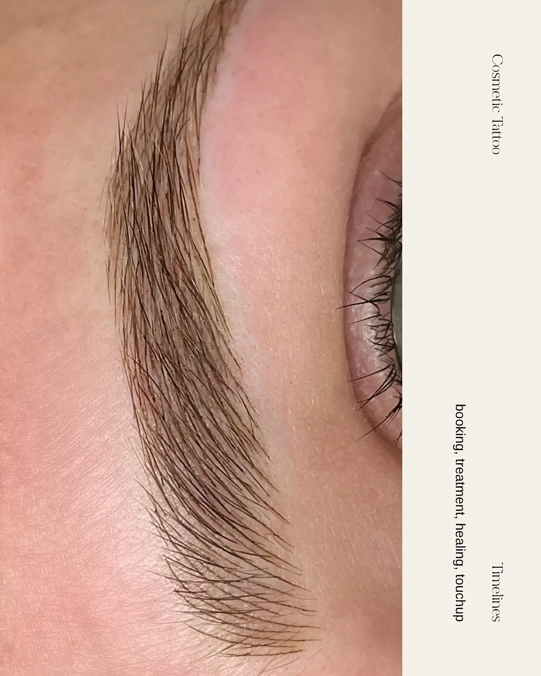 Where artistry and clinical excellence is met with a gentle and warm approach. 

Every step of your journey with us is guided by support and education. Nothing is left unanswered so you can feel confident in the process and your results. 

Save this 