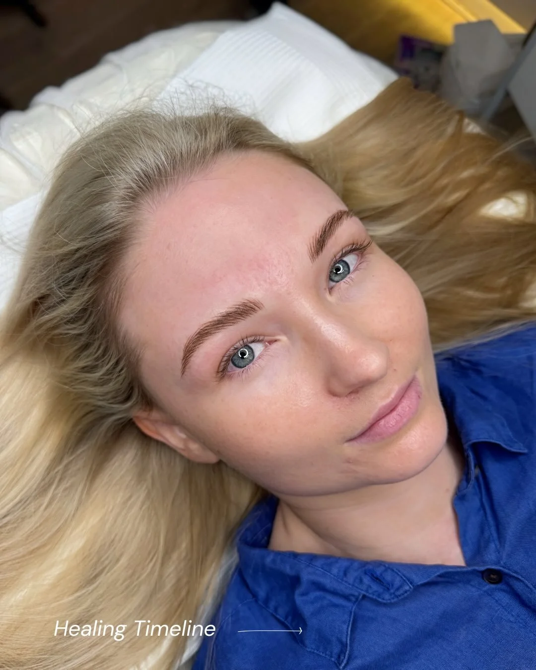 Day 1 &rarr; Day 7 &rarr; Week 6 🤍

Cosmetic tattooing is a process - not an instant result.

What you see immediately isn&rsquo;t the final outcome - the real result reveals itself once the skin has settled.

Trust the timeline. The softness comes 